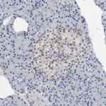 PDLIM2 Antibody in Immunohistochemistry (Paraffin) (IHC (P))
