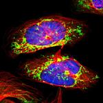 NDUFS4 Polyclonal Antibody