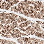 NDUFB8 Antibody in Immunohistochemistry (Paraffin) (IHC (P))