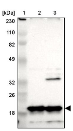 NDUFB8 Antibody in Western Blot (WB)