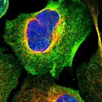 LAX1 Polyclonal Antibody