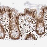 RNF122 Antibody in Immunohistochemistry (Paraffin) (IHC (P))