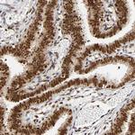 RNF122 Antibody in Immunohistochemistry (Paraffin) (IHC (P))