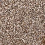 RNF122 Antibody in Immunohistochemistry (Paraffin) (IHC (P))