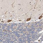 FAM118A Antibody in Immunohistochemistry (Paraffin) (IHC (P))