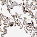 FAM118A Antibody in Immunohistochemistry (Paraffin) (IHC (P))