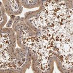 VSIG4 Antibody in Immunohistochemistry (IHC)
