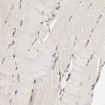 VSIG4 Antibody in Immunohistochemistry (IHC)