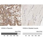 VSIG4 Antibody