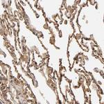 VSIG4 Antibody in Immunohistochemistry (IHC)