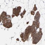 PPFIBP2 Antibody in Immunohistochemistry (Paraffin) (IHC (P))
