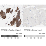 PPFIBP2 Antibody in Immunohistochemistry (Paraffin) (IHC (P))