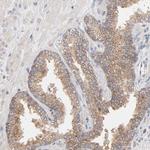 PPFIBP2 Antibody in Immunohistochemistry (Paraffin) (IHC (P))