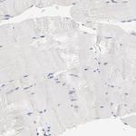 PPFIBP2 Antibody in Immunohistochemistry (Paraffin) (IHC (P))