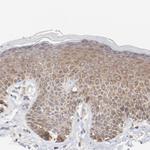 PPFIBP2 Antibody in Immunohistochemistry (Paraffin) (IHC (P))