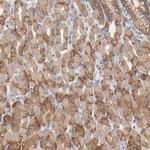 PPFIBP2 Antibody in Immunohistochemistry (Paraffin) (IHC (P))