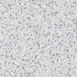 BAF57 Antibody in Immunohistochemistry (IHC)