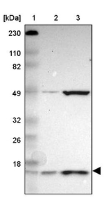 UBE2D2 Antibody in Western Blot (WB)