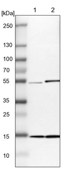 UBE2D2 Antibody in Western Blot (WB)