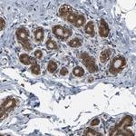 UBE2D2 Antibody in Immunohistochemistry (Paraffin) (IHC (P))