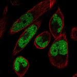 MAMLD1 Polyclonal Antibody