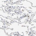 VIP36 Polyclonal Antibody