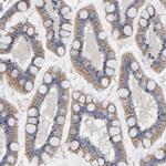 CCDC134 Antibody in Immunohistochemistry (Paraffin) (IHC (P))