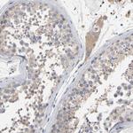 CCDC134 Antibody in Immunohistochemistry (Paraffin) (IHC (P))
