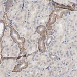 DYNLT3 Antibody in Immunohistochemistry (Paraffin) (IHC (P))