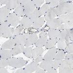 DYNLT3 Antibody in Immunohistochemistry (Paraffin) (IHC (P))