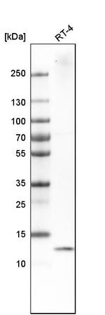 DYNLT3 Antibody in Western Blot (WB)