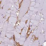 ITIH4 Antibody in Immunohistochemistry (IHC)