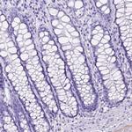 ITIH4 Antibody in Immunohistochemistry (IHC)