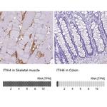 ITIH4 Antibody