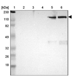 ITIH4 Antibody in Western Blot (WB)