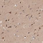 PITPNM2 Antibody in Immunohistochemistry (Paraffin) (IHC (P))