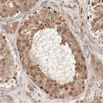 PITPNM2 Polyclonal Antibody