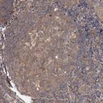 PITPNM2 Antibody in Immunohistochemistry (Paraffin) (IHC (P))