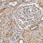 PKN1 Antibody in Immunohistochemistry (IHC)