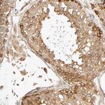 SGSM1 Polyclonal Antibody