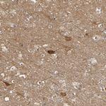 SGSM1 Antibody in Immunohistochemistry (IHC)