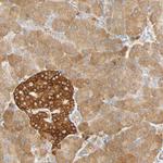 SGSM1 Antibody in Immunohistochemistry (IHC)