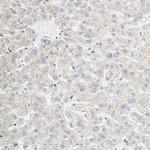 SGSM1 Antibody in Immunohistochemistry (IHC)