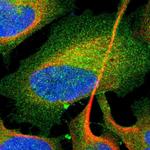 RAB13 Polyclonal Antibody