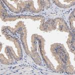 RAB13 Antibody in Immunohistochemistry (Paraffin) (IHC (P))