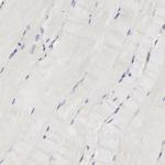 RAB13 Antibody in Immunohistochemistry (Paraffin) (IHC (P))