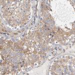 RAB13 Antibody in Immunohistochemistry (Paraffin) (IHC (P))