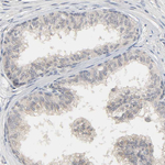 MAGEA8 Antibody in Immunohistochemistry (Paraffin) (IHC (P))