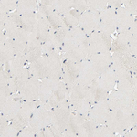 MAGEA8 Polyclonal Antibody