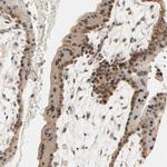MAGEA8 Antibody in Immunohistochemistry (IHC)